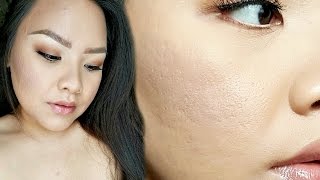 How to MINIMIZE INDENTED ACNE SCARS with Makeup ♡ Cynthia Hang [upl. by Servais]