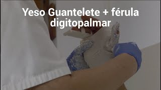 Yeso Guantelete  férula digitopalmar  Fracture amp Plaster [upl. by Horne]