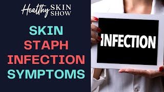 Symptoms Of A STAPH INFECTION On Your Skin  Jennifer Fugo [upl. by Ardyce]