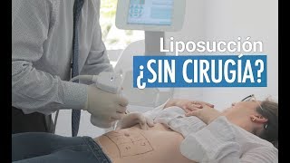 Liposucción sin Cirugía [upl. by Adym690]