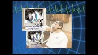 Video Tour of a Sleep Study [upl. by Lukash]