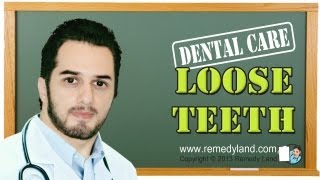 Loose teeth or loose tooth treatment [upl. by Lawan116]