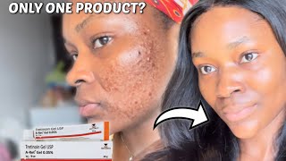 HOW TO ACHIEVE YOUR DREAM SKIN WITH TRETINOIN  How to use Tretinoin for beginners tretinoin [upl. by Kristal567]