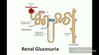 Renal glucosuria [upl. by Eceined]