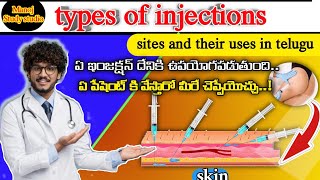 Types Of Injections Sites and Uses Common Injections and Their Uses manojstudystudio [upl. by Tareyn]