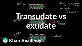 Transudate vs exudate  Respiratory system diseases  NCLEXRN  Khan Academy [upl. by Trometer]