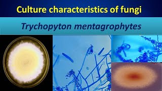 Trychopyton mentagrophytesDermatophytes you must know [upl. by Ellemac]