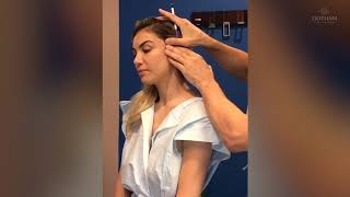 Ponytail Micro Lift Procedure by Dr Miller [upl. by Salokin]