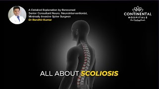 All About Scoliosis Dr Randhir Kumar Neurosurgeon [upl. by Aihsatal10]