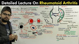 Rheumatoid Arthritis Pathophysiology of Arthritis [upl. by Fine116]