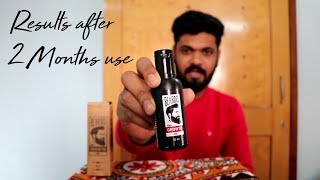 Beardo hair growth oil  Review amp usage technique  After 2 month use [upl. by Niemad]