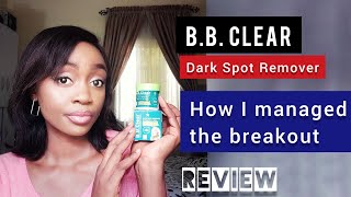 How to Remove Dark Spots and Get Clear Skin Pigmentation Dark Underarms Acne scars amp more [upl. by Rothschild]