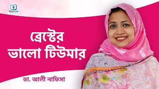 ব্রেস্টের ভালো টিউমার  Breast Lump Symptoms [upl. by Louie11]