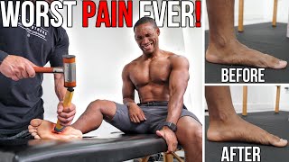 The WORST PAIN  Fixing 291 YEARS Of Flat Feet w Trigger Point Massage [upl. by Lauritz]