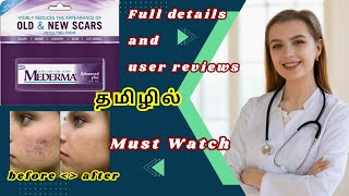 Best and Worst mederma cream review  Mederma cream  thalumbu cream  Scar  தழும்பு  beauty [upl. by Nerhtak]