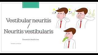 Vestibular neuritis  Neuritis vestibularis Essential medicine [upl. by Amlus142]