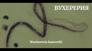 Вухерерия Wuchereria bancrofti  Жизненный Цикл Размеры Симптомы Диагностика Профилактика [upl. by Isobel]