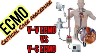 ECMO VV VS VA ECMO [upl. by Enihpets]