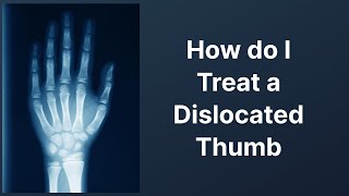 How do I Treat a Dislocated Thumb [upl. by Pansy]