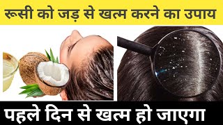 रूसी को जड़ से खत्म करने के घरेलू उपाय Hair Care Tips dandruffyoutube viral [upl. by Surtemed]