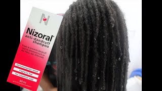 NIZORAL ANTI DANDRUFF SHAMPOO FIRST IMPRESSIONS HMMMMMM [upl. by Onailime]