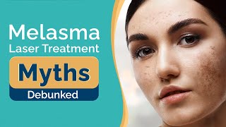 10 Melasma Laser Treatment Myths Debunked  Melasma Treatment  Dr Jangid  SkinQure [upl. by Annayat]