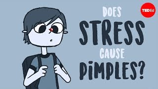 Does stress cause pimples  Claudia Aguirre [upl. by Clyde]