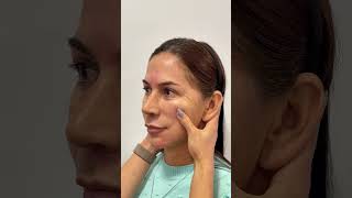 ELA NAO ACREDITOU NO RESULTADO rejuvenescimentofacial hof bioestimuladordecolageno protocoll [upl. by Delora]