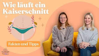 Der Kaiserschnitt Ablauf – Die wichtigsten Fakten und Tipps von uns  hallohebamme [upl. by Sampson]