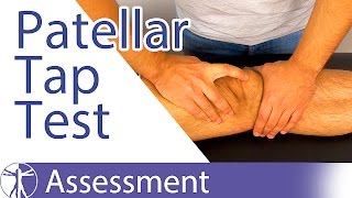 Patellar Tap Test  Ballottement Test⎟Knee Swelling [upl. by Erasmus]