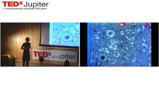 Neurodegenerative disease Corinne Lasmezas at TEDxJupiter [upl. by Keven14]