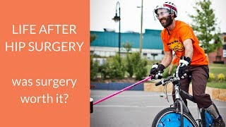 Is surgery for a hip labral tear worth it Jawns journey with hip pain [upl. by Reagen357]