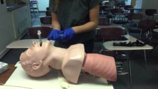 Extubation procedure [upl. by Knowle]