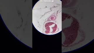 TS of rectum slide under microscope 🔬shorts [upl. by Etz]