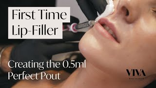 Getting Lip Fillers for the First Time 🧪 Everything You Need to Know about Lip Fillers [upl. by Vaden339]