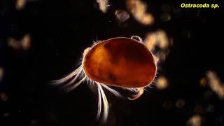 Ostracoda sp  Protozoans and other small critters [upl. by Lad]