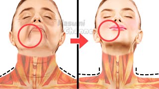 10MIN FACE LIFT SLIM JAWLINE  NO LAUGH LINES  DOUBLE CHIN REMOVAL  NO WRINKLES  GET SLIM NECK [upl. by Ytsim]