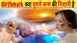 Birthmark क्या पूर्व जन्म की निशानी हैं  why birthmark in body Birthday sachh24 shorts [upl. by Gaither]