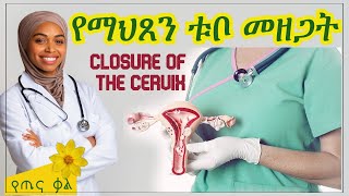 የማህጸን ቱቦ መዘጋት  Closure of the cervix [upl. by Ianthe240]