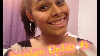 Invisalign Update 2 Trays 315 [upl. by Adest]