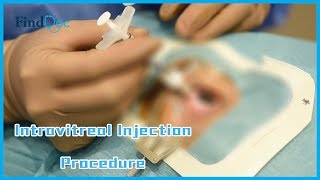 Intravitreal Injection Procedure Demonstration  Dr Yip Pui Pui 眼球注射示範教學影片  葉佩珮眼科專科醫生 [upl. by Erodasi]