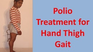 Polio Treatment for Hand Thigh Gait [upl. by Jann]