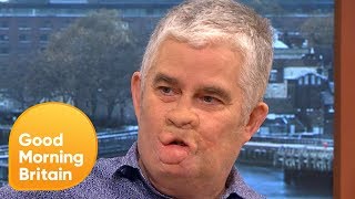 Sepsis Survivor Opens Up About His 18 Year Story  Good Morning Britain [upl. by Pietra]