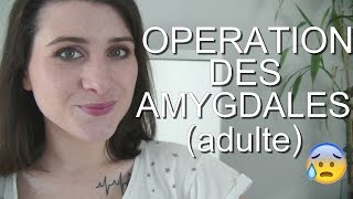 Mon HORRIBLE opération des amygdales à lage adulte [upl. by Nnaul]