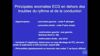 ECG normale er principales anomalies Partie 4 [upl. by O'Donnell]