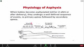 Pediatric Lecture on Perinatal Asphyxia Part 2 [upl. by Yessac40]