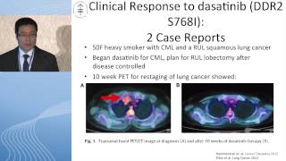 Squamous cell carcinoma Is there hope for targeted therapy [upl. by Niffirg]