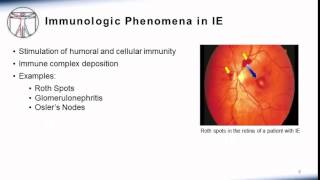 Endocarditis Clinical Manifestation [upl. by Elene]