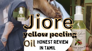 jiore yellow peeling oil  My Honest review in tamil 🧴💯🤚yellow peeling oil review in tamil [upl. by Nyram413]