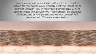 Levulan Patient Education Video [upl. by Besse]